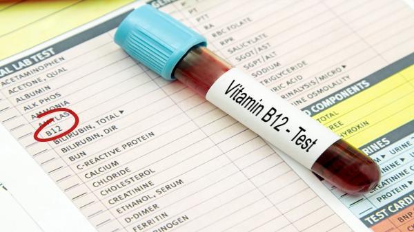 بیماری خطرناکی که با کمبود ویتامین B 12 مرتبط است